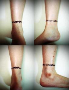 足首一周にリアルな傷口のタトゥー